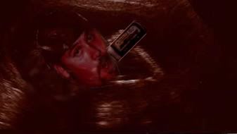 84Sonogram.jpg