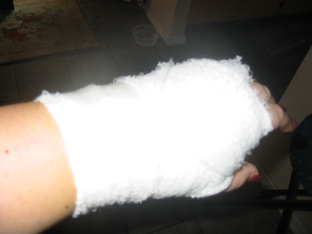 Stitches On Hand
